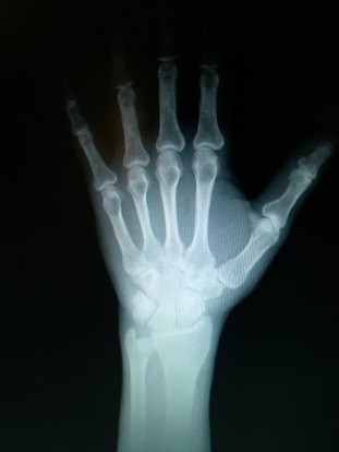 x-ray hand1.jpg